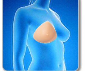 prothèse mammaire transitoire